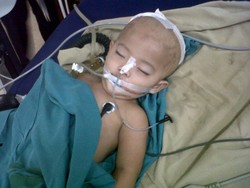 Proyektil di Kepala Bayi yang Terkena Peluru Nyasar Berhasil Diangkat