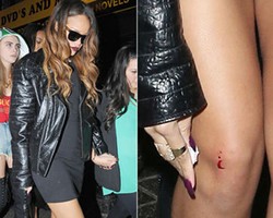 Mesra dengan Chris Brown, Rihanna Dilempar Botol Saat Dugem