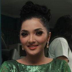 Apa Penyebab Ashanty Terkena Radang Selaput Otak?