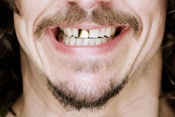 Manfaat Sehat Jenggot & Kumis: Mencegah Asma & Melawan Batuk