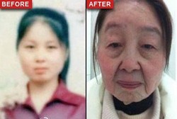 Usai Melahirkan, Kulit Wanita 28 Tahun Ini Keriput Seperti Nenek-nenek 