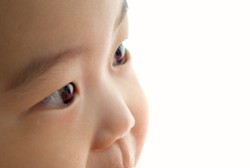 Waspada, 3 Masalah Mata Ini Sering Terjadi pada Bayi 