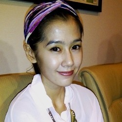 Ardina Rasti Masih Jalani Terapi Psikologi