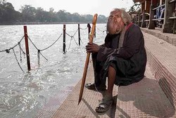 Penyakit Langka Bikin Wajah Bengkak, Pria Ini Tetap Bersyukur 