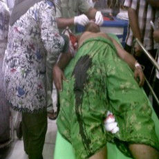 Polisi Diminta Usut Pembacokan Korlap Aksi Demo Kontra Bupati Bangkalan