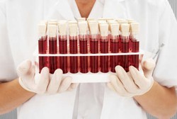 Cari Tahu Kecenderungan Terserang Penyakit Sesuai Golongan Darah