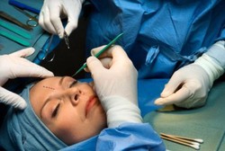 Amankah Mengotak-atik Tubuh Lewat Bedah Plastik?