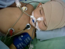 Bayi 1 Tahun Terkena Peluru Nyasar di Makassar, Meninggal Dunia