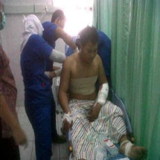 Pembacok Aktivis Diduga Pendukung Bupati Bangkalan