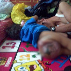 Adin, Batita Tumor Ganas Butuh Segera Tindakan