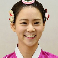 Dagu Berubah Bentuk, Seungyeon KARA Dituduh Operasi Plastik