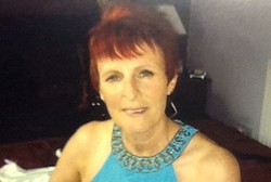 Takut Kena Kanker, Wanita Ini Nekat Jalani Hidup Tanpa Usus