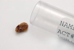 Kena Batu Ginjal Atau Tidak? Cek di Sini