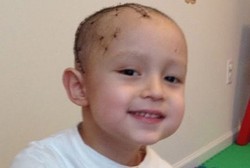 Bocah yang Kejang 100 Kali dalam Sehari Ini Akhirnya Sembuh Setelah Operasi