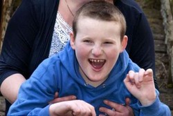 Kena Sindrom Langka, Edgar Tak Bisa Berhenti Tersenyum dan Tertawa