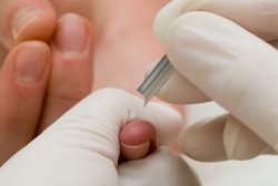 Bukan Tusuk Jari, Ini yang Seharusnya Dilakukan Saat Stroke