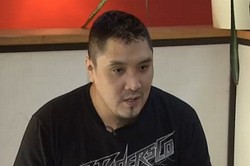 Punggung Terasa Nyeri, Ternyata Ada Mata Pisau Bersarang Selama 3 Tahun