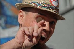 Hidup Tanpa Bola Mata, Tangan Pria Ini Bisa Tembus ke Lubang Matanya