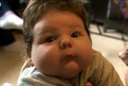 Punya 10% Kesempatan Bertahan Hidup, Bayi Raksasa Seberat 7 kg Dilahirkan