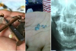 Fenomena Berbau Mistis yang Pernah Ditangani Dokter Indonesia