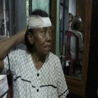 Lindungi Tiga Cucu Dari Angin Puting Beliung, Buari Dapat Tujuh Jahitan di Kepala