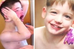 Gara-gara Autis Parah, Anak Ini Diobati Pakai Ganja