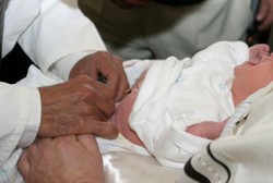 Masih Bayi Sudah Kena Herpes karena Terinfeksi Waktu Disunat