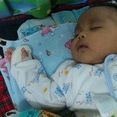 Bayi Edwin Diamputasi Diam-diam, Komnas PA: Ada Dugaan Malpraktik