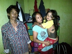 Fatihayah, Bocah Diduga Menderita Kelamin Ganda Ingin Sekolah