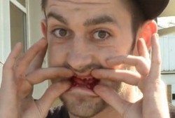 Sakit Gigi Biasa, Dokter Malah Cabut Semua Gigi Pria Ini Tanpa Izin