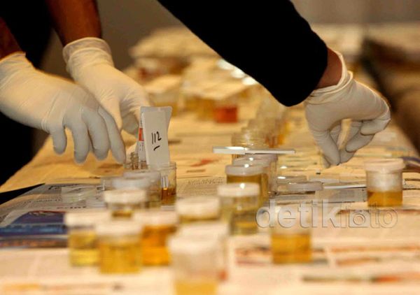 Bakal Caleg dari Partai NasDem Dites Urin