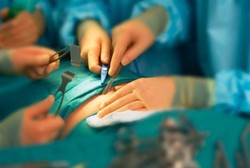 Prosedur yang Harus Dipenuhi Saat Dokter Melakukan Amputasi