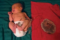 Lotus Birth, Metode Lahiran Baru asal Bali yang Ngetren di Barat