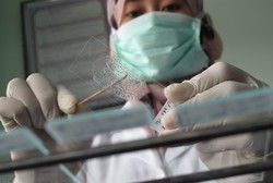 Dokter Puskesmas Kewalahan Melacak Pasien TBC yang Mangkir Berobat