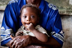 Kemenkes Tegaskan Tidak Ada Wabah Busung Lapar di Papua