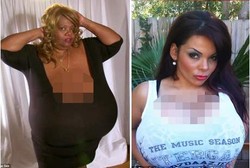 Wanita-wanita yang Dapat Malapetaka karena Berpayudara Super Besar