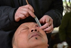 Di China Ada Tempat Cukur Bola Mata Pakai Pisau, Berminat Mencoba?
