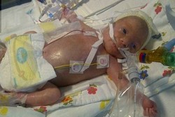 Bayi 11 Hari Meninggal di Rumah Sakit karena Petugas Malas Cuci Tangan