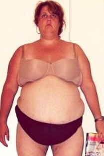 Tubuh Gemuknya Sering Jadi Bahan Ejekan, Wanita Ini Pangkas 90 Kg