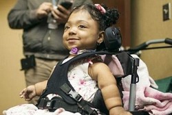 Terlahir Tanpa Tulang, Gadis Cilik Ini Kini Mulai Belajar Menari