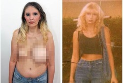 Wanita Monster, Payudaranya Besar Sebelah Selama 15 Tahun