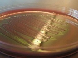 Ada Bakteri yang Bisa Menghasilkan Bensin