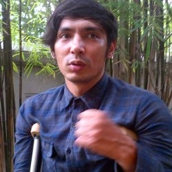 Syuting Coboy Junior The Movie, Abimana Patah Kaki