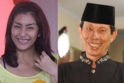 Sama-sama Gusi Nongol, Ini Bedanya Gummy Smile dengan Tonggos