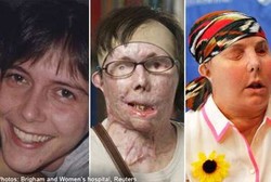 Hancur Disiksa Suami, Wanita Ini Sekarang Punya Wajah Baru