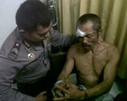 Polisi Berencana Periksa Kejiwaan Fasikun Senin Depan