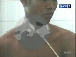 Bermain Panah, Leher pun Tertembus