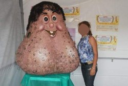 Senor Testiculo, Testis Raksasa yang Jadi Maskot Unik Kanker Testis