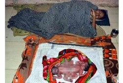 Hebat! Tanpa Bantuan Dokter, Wanita Ini Lahirkan Bayi Kembar Dempet