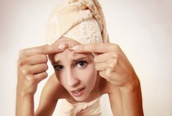 Awas, Ini Bahayanya Sembarangan Pencet Jerawat